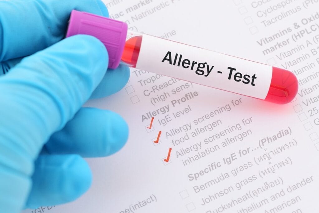 Different methods of allergy testing demonstrated in clinical setting