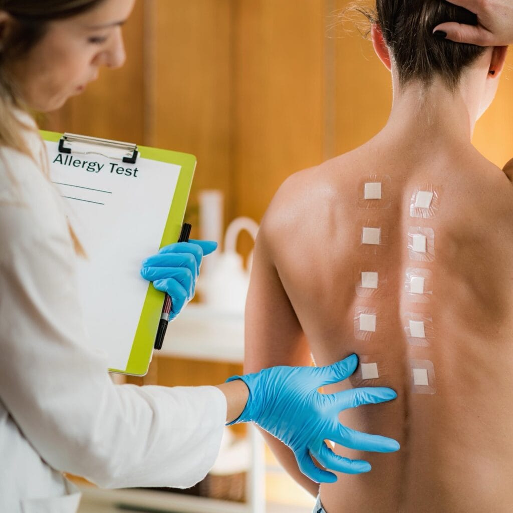 Allergy testing in San Antonio